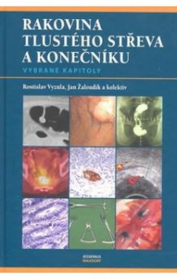 RAKOVINA TLUSTÉHO STŘEVA A KONEČNÍKU