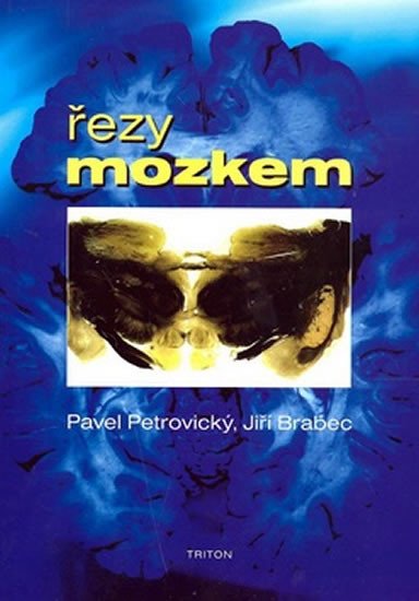 ŘEZY MOZKEM