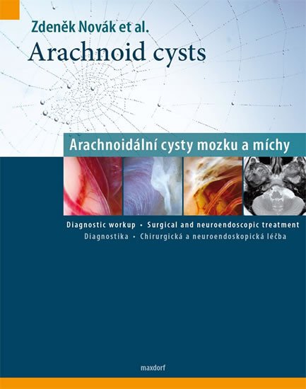 ARACHNOID CYSTS ARACHNOIDÁLNÍ CYSTY MOZK