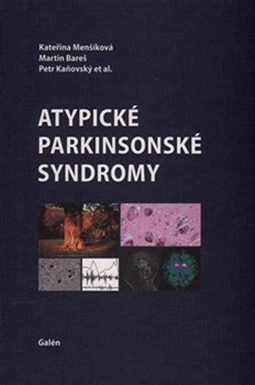 ATYPICKÉ PARKINSONSKÉ SYNDROMY