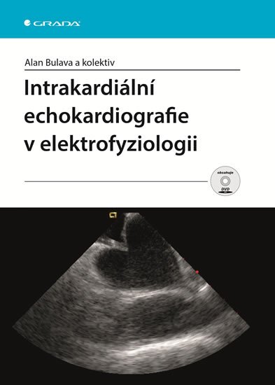 INTRAKARDIÁLNÍ ECHOKARDIOGRAFI