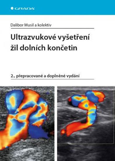 ULTRAZVUKOVÉ VYŠETŘENÍ ŽIL DOLNÍCH KONČETIN