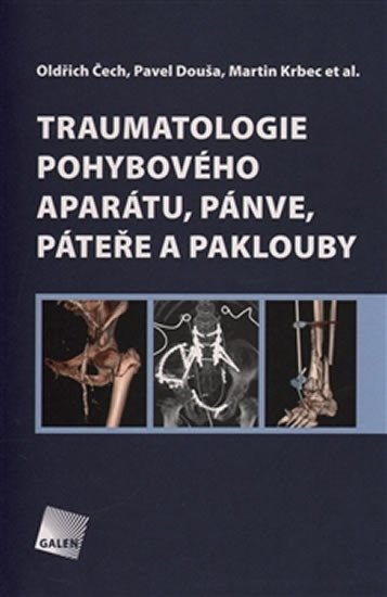 TRAUMATOLOGIE POHYBOVÉHO APARÁTU, PÁNVE, PÁTEŘE A PAKLOUBY