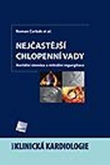 NEJASTJ CHLOPENN VADY KLINICK KARDIOLOGIE