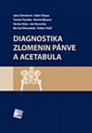 DIAGNOSTIKA ZLOMENIN PNVE A ACETABULA