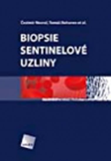 BIOPSIE SENTINELOV UZLINY