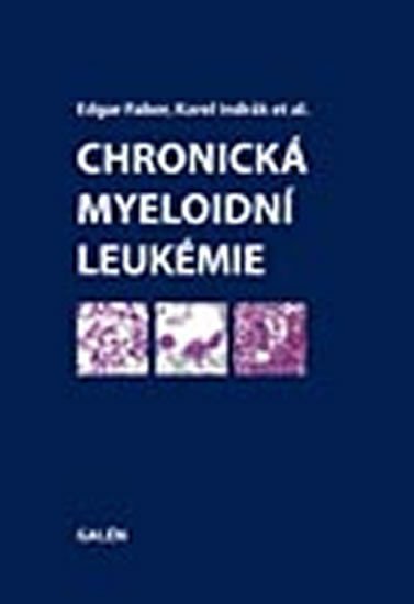 CHRONICK MYELOIDN LEUKMIE