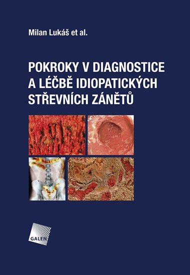 POKROKY V DIAGNOSTICE A LÉČBĚ IDIOPATICKÝCH STŘEVNÍCH ZÁNĚTŮ