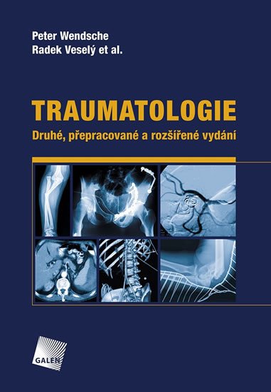 TRAUMATOLOGIE [2. PŘEPRACOVANÉ A ROZŠÍŘENÉ VYDÁNÍ]