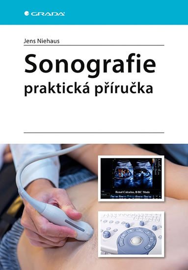 SONOGRAFIE - PRAKTICKÁ PŘÍRUČKA