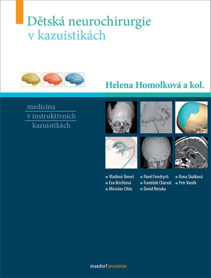 DĚTSKÁ NEUROCHIRURGIE V KAZUISTIKÁCH