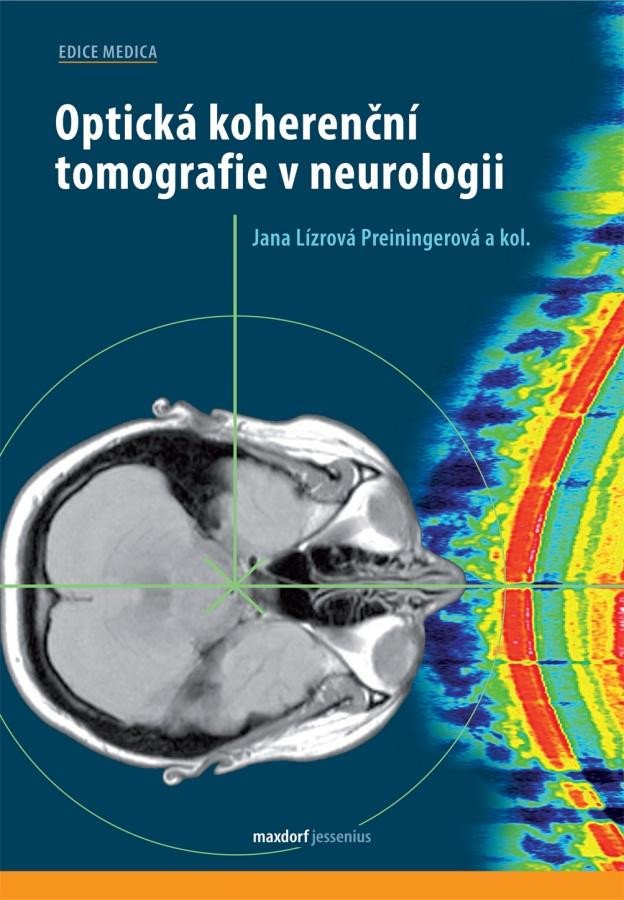 OPTICKÁ KOHERENČNÍ TOMOGRAFIE V NEUROLOGII