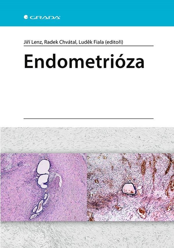 ENDOMETRIÓZA