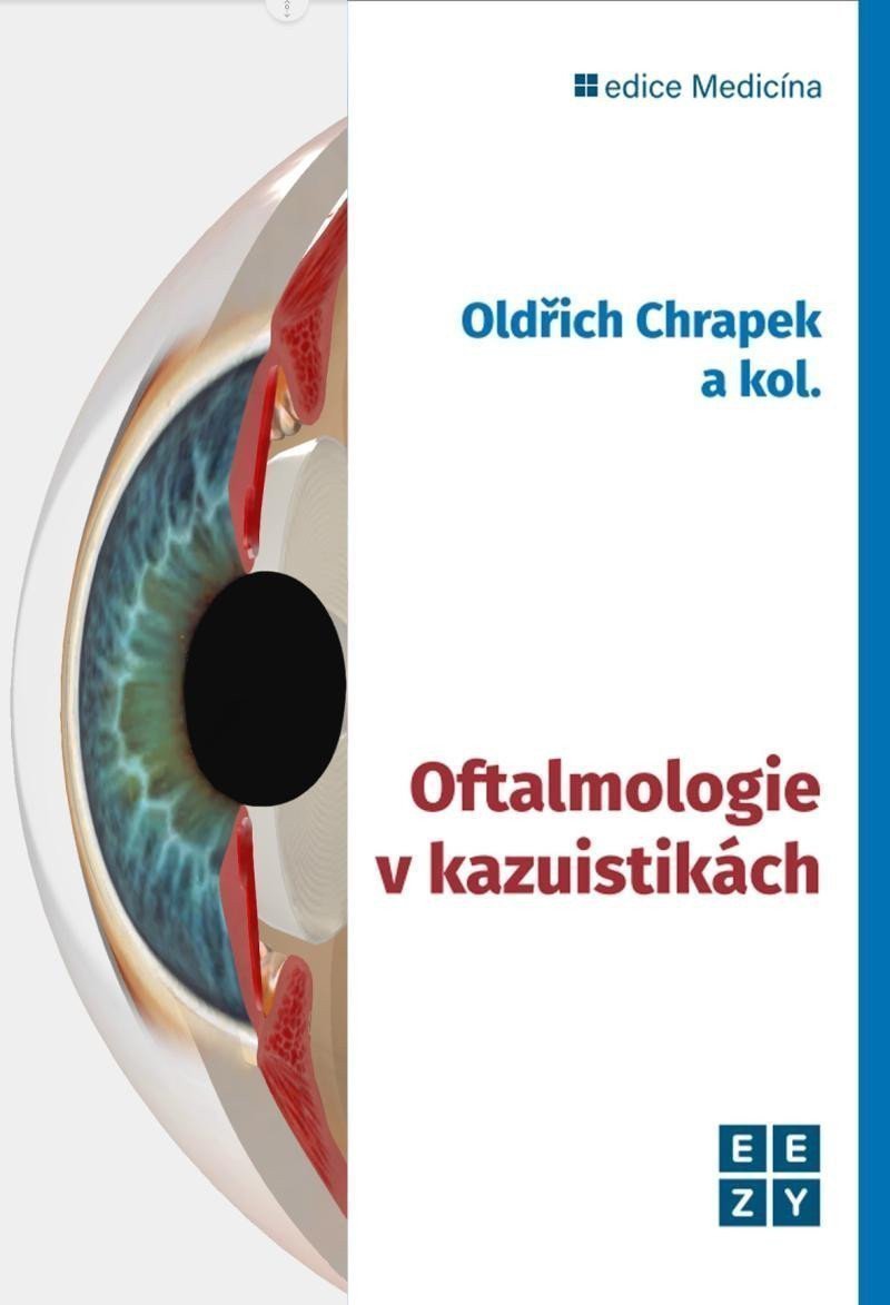 OFTALMOLOGIE V KAZUISTIKÁCH