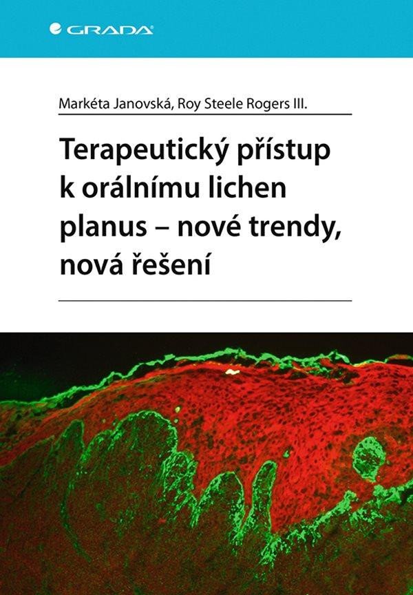 TERAPEUTICKÝ PŘÍSTUP K ORÁLNÍMU LICHEN PLANUS - NOVÉ TRENDY,