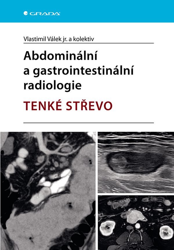 ABDOMINÁLNÍ A GASTROINTESTINÁLNÍ RADIOLOGIE