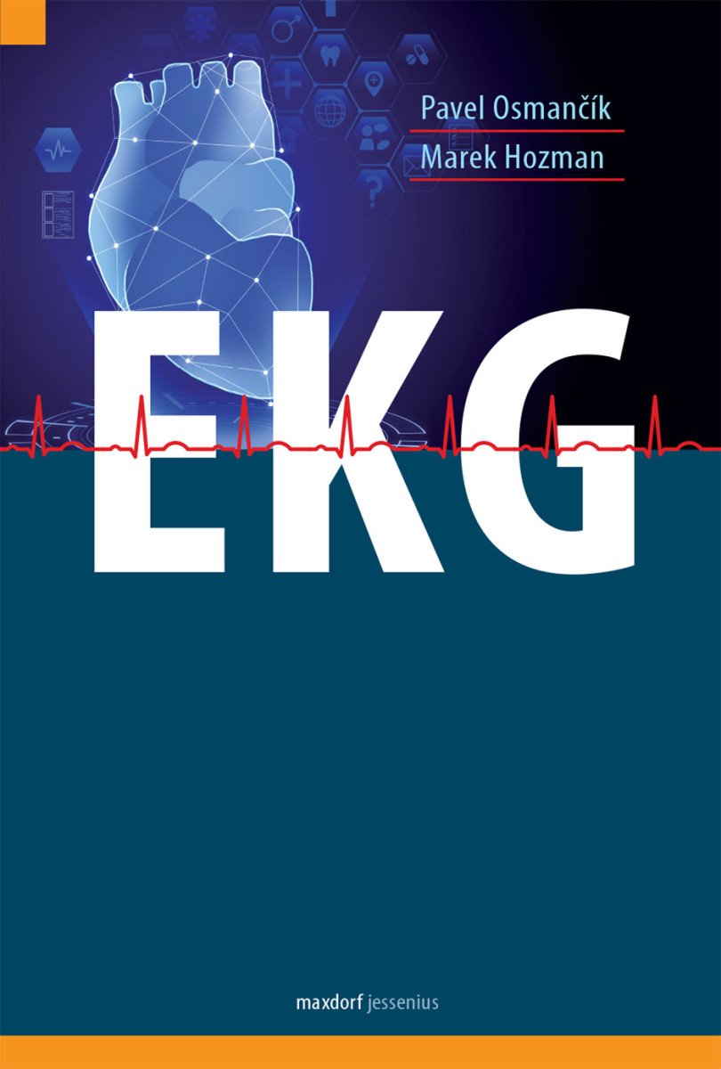 EKG