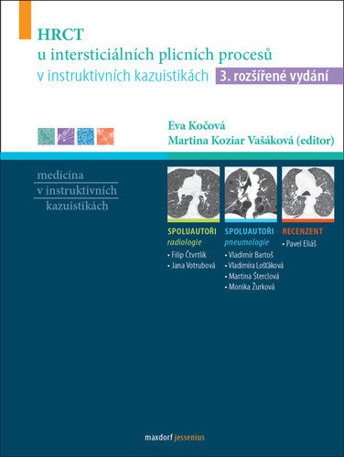HRCT u intersticiálních plicních procesů v instruktivních kazuistikách